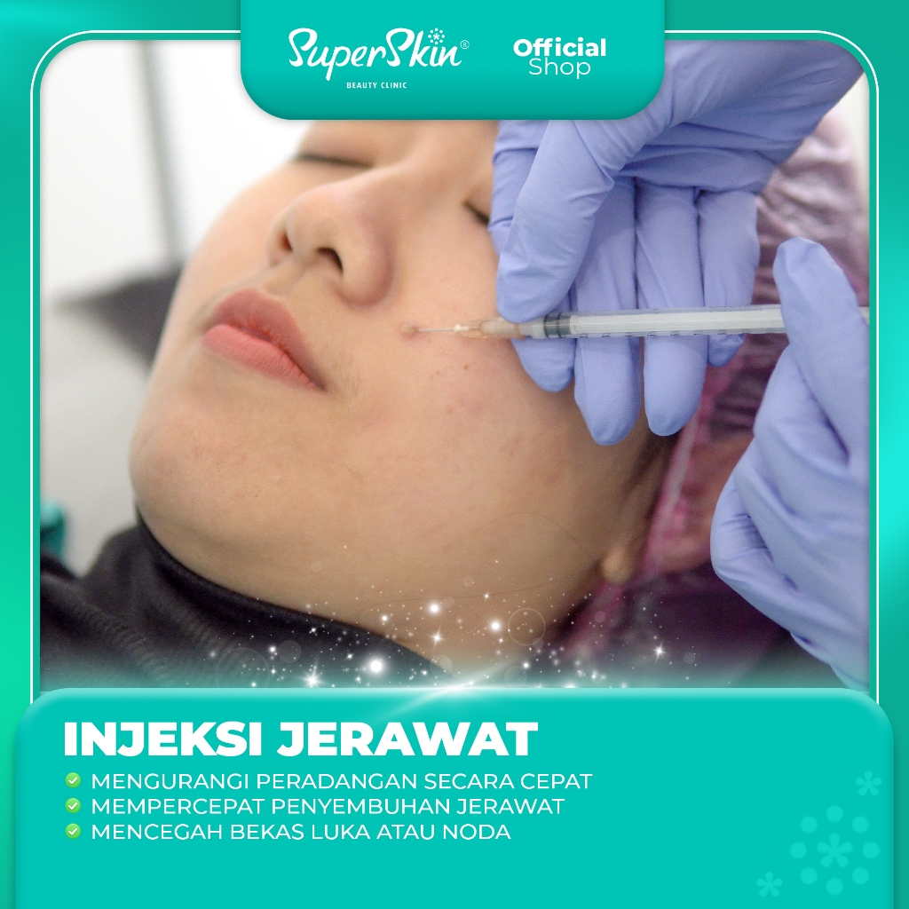 Harga Injeksi Jerawat Terbaru Agt 2025 | BigGo Indonesia
