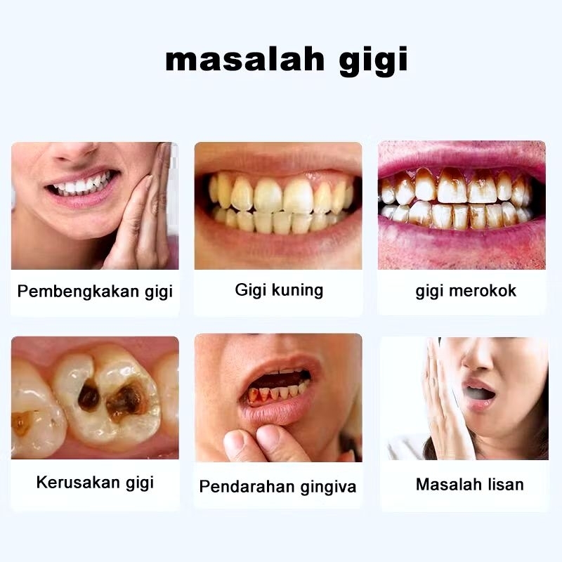 Pasta Gigi Pemutih Pasta Gigi Baking Soda Pemutih Pemutih Gigi Kuning Permanen