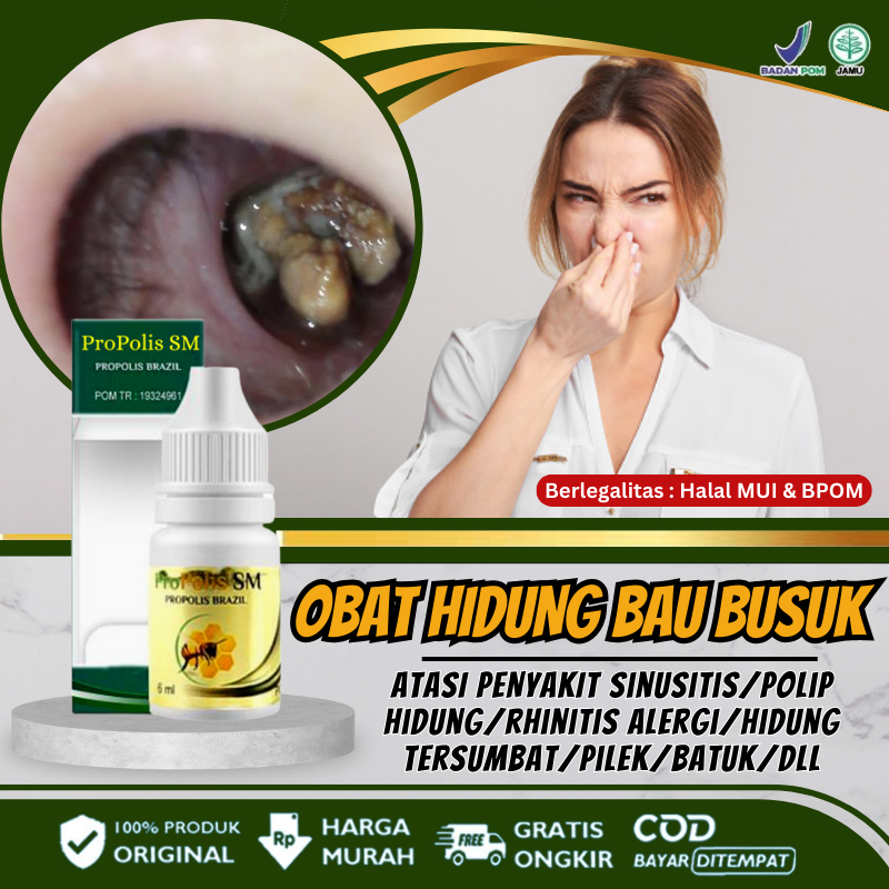 Obat Hidung Berbau Nanah, Berbau Busuk Akibat Penyakit Sinusitis Akut / Kronis, Obat Polip Hidung, H