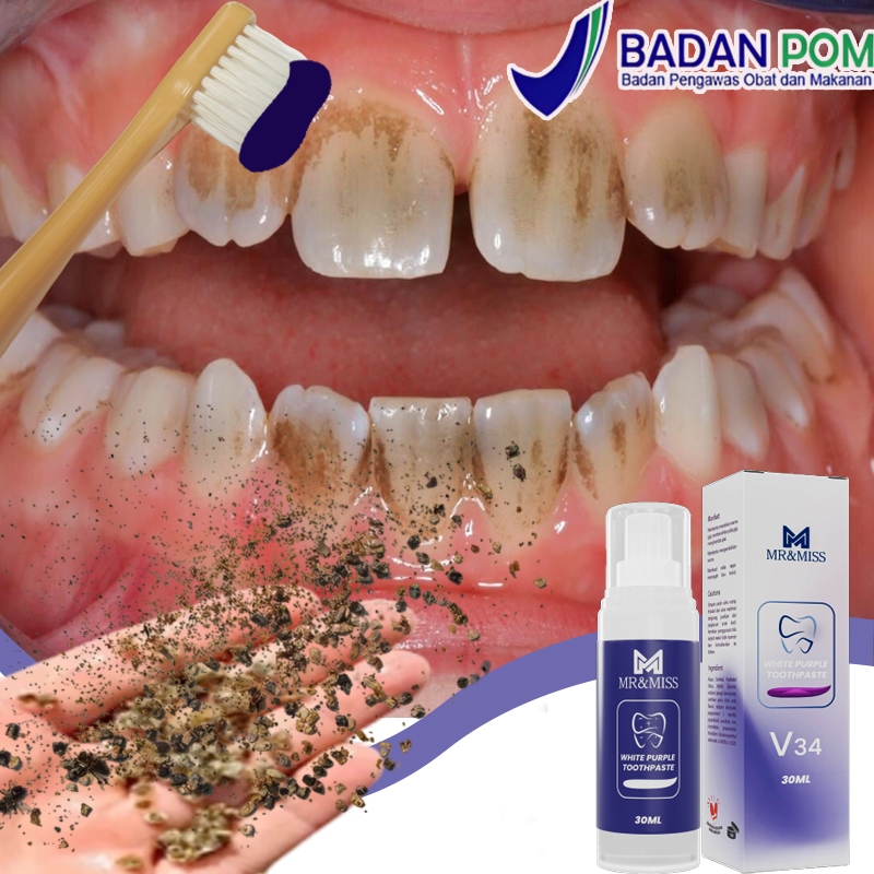 Odol pemutih gigi dan karang gigi pasta gigi pemutih Penghilang karang gigi Pemutih gigi ampuh 100% 
