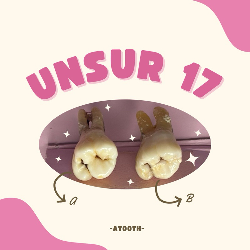 Unsur Gigi praktikum 17