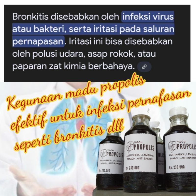 

madu PROPOLIS mantap.madu untuk paru². madu obat untuk perokok.BUKAN Propolis PABRIKAN.sehatnya alami