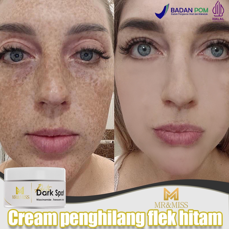 【BPOM】Cream penghilang flek hitam cream flek hitam membandel penghilang flek hitam di wajah 30g peng