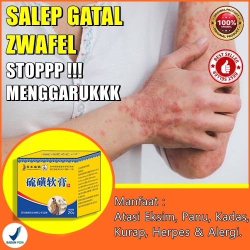 {100% asli} Salep Eksim Salep Gatal Eksim Salep Asam Sulfosalisilat Salep Belerang Paling Ampuh Meng