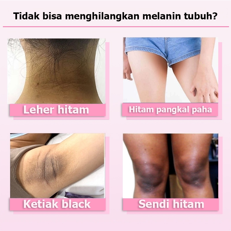 Memutihkan selangkangan hitam cream pemutih selangkangan bpom pemutih selangkangan ampuh 20g