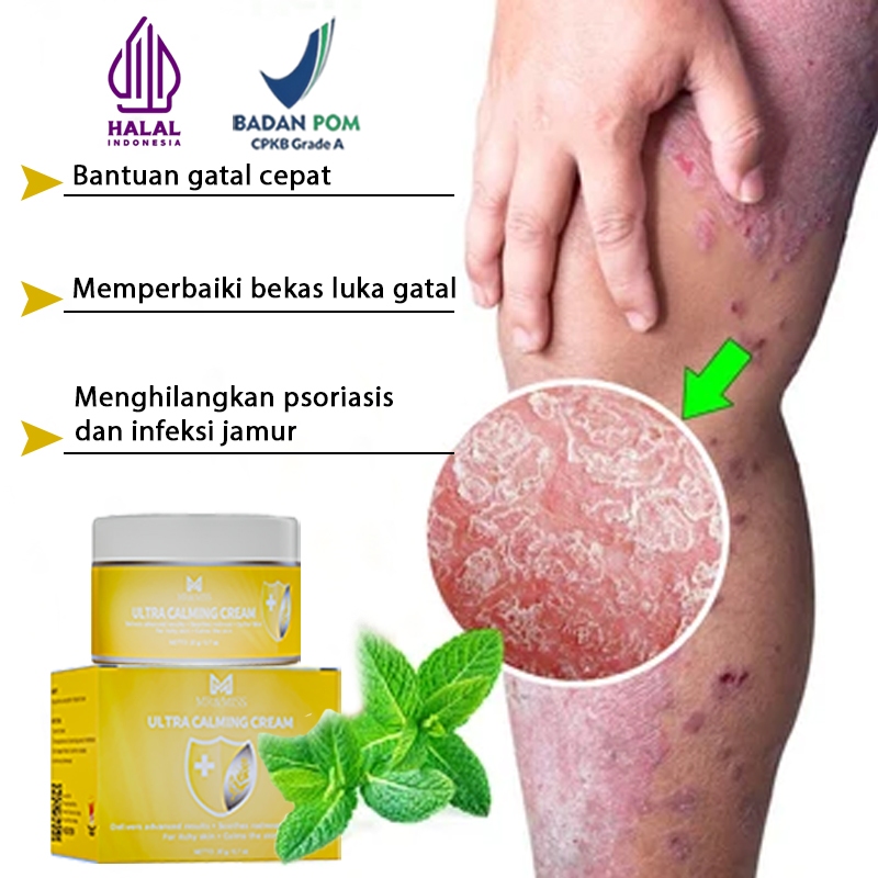 Obat gatal salep gatal selangkangan salep gatal china paling ampuh salep eksim kering paling ampuh 2