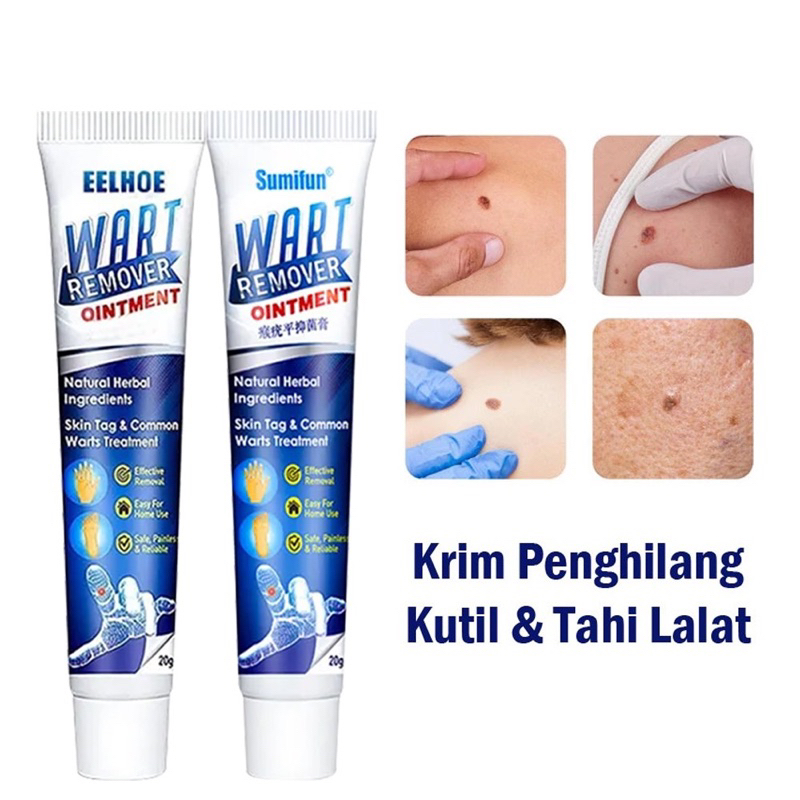 Sumifun Eelhoe menghilangkan tahi lalat dan kutil / KRIM AMPUH MENGHILANGKAN KUTIL & TAHI LALAT