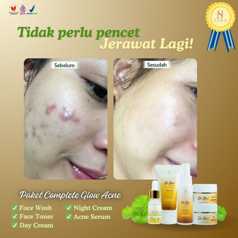 SH SKIN - PAKET COMPLETE GLOW