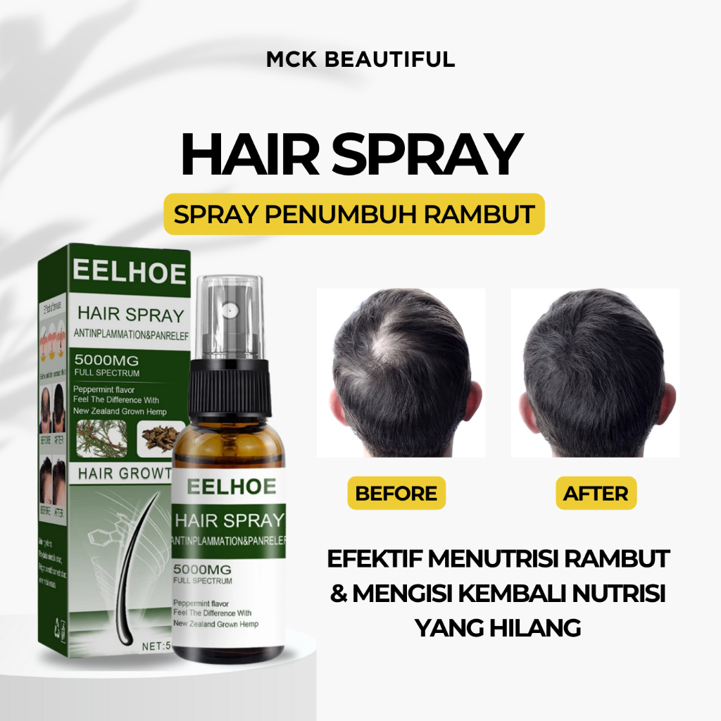 EELHOE HAIR SPRAY/GINGER HAIR HEALTH SPRAY EELHOE Penumbuh rambut 50ML Scalp Repair/Rapid hair growt