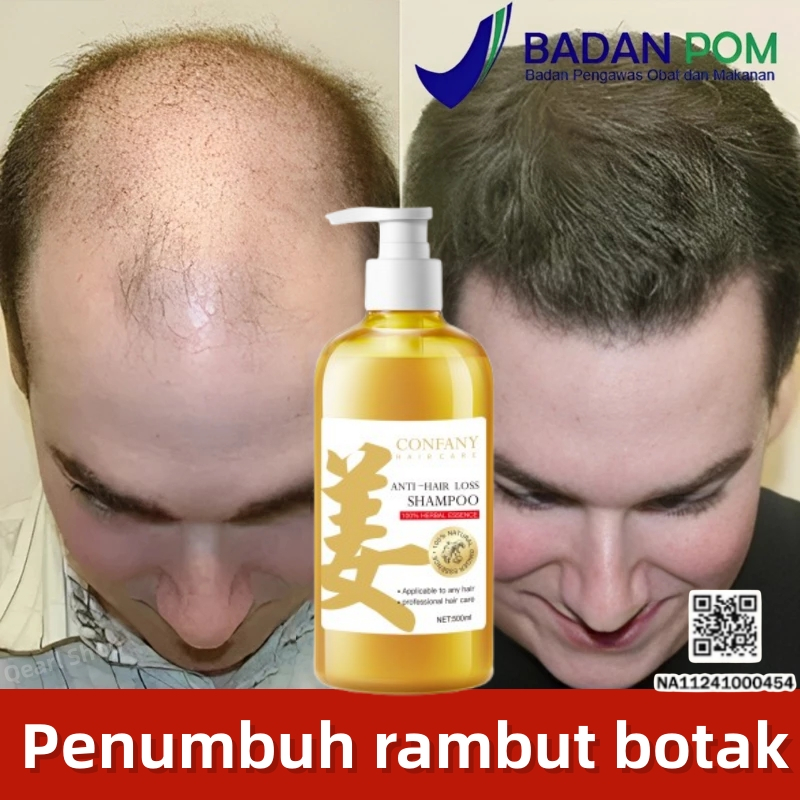 BPOM Shampo Penumbuh Rambut Cepat perawatan rambut rontok shampo rambut rontok Penumbuh Rambut Botak