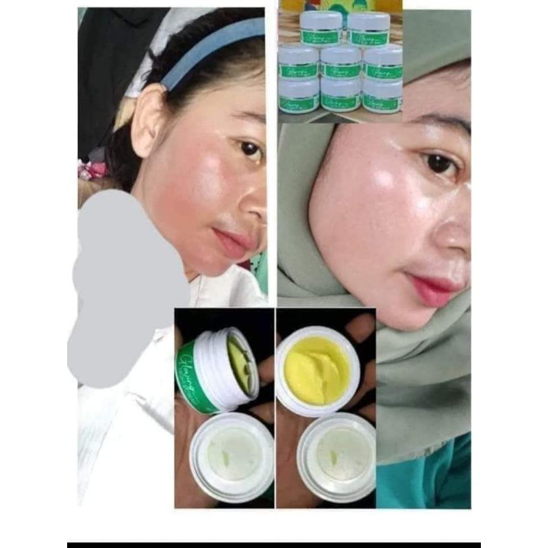 Cream khusus FLEK Hitam Maxie Skincare