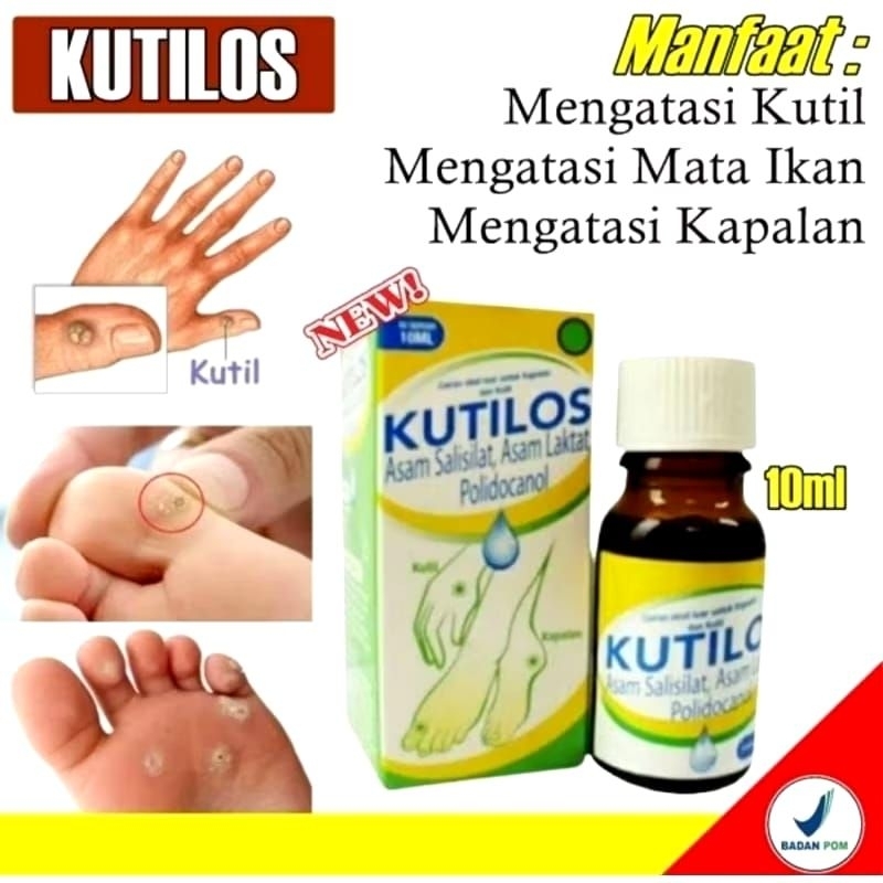 Kutilos untuk matan ikan , kutil