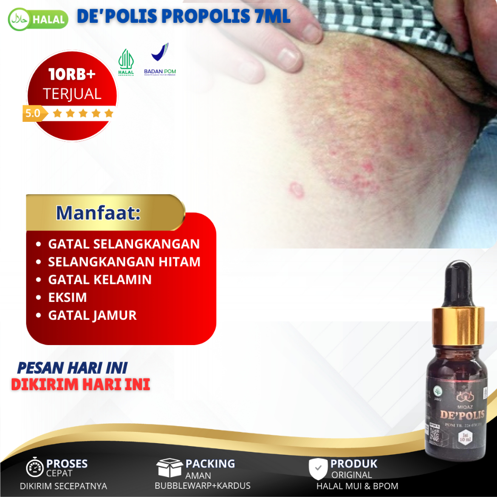 Obat Gatal di Selangkangan, Gatal Area Kemaluan, Penghilang Gatal di Selangkangan, Gatal di Kemaluan