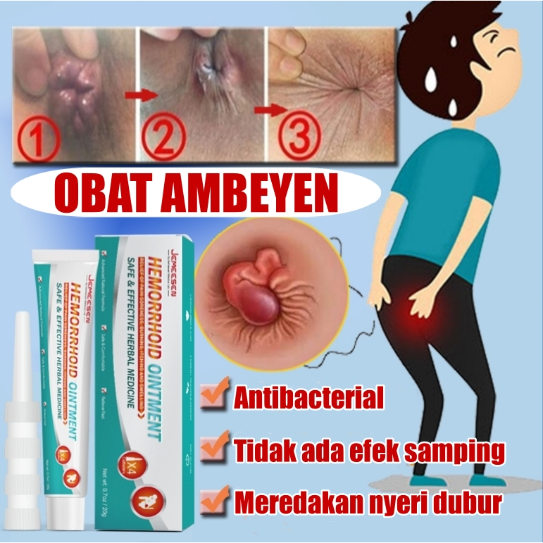 Jemeesen Obat Ambeyen Dan Wasir Salep Ambeien Paling Ampuh Salep Ambeien Mengobati Wasir Untuk Mengu
