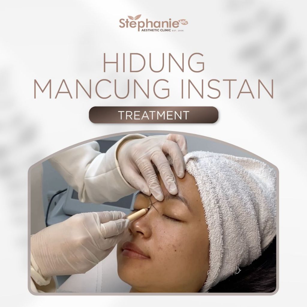 HIDUNG MANCUNG INSTANT