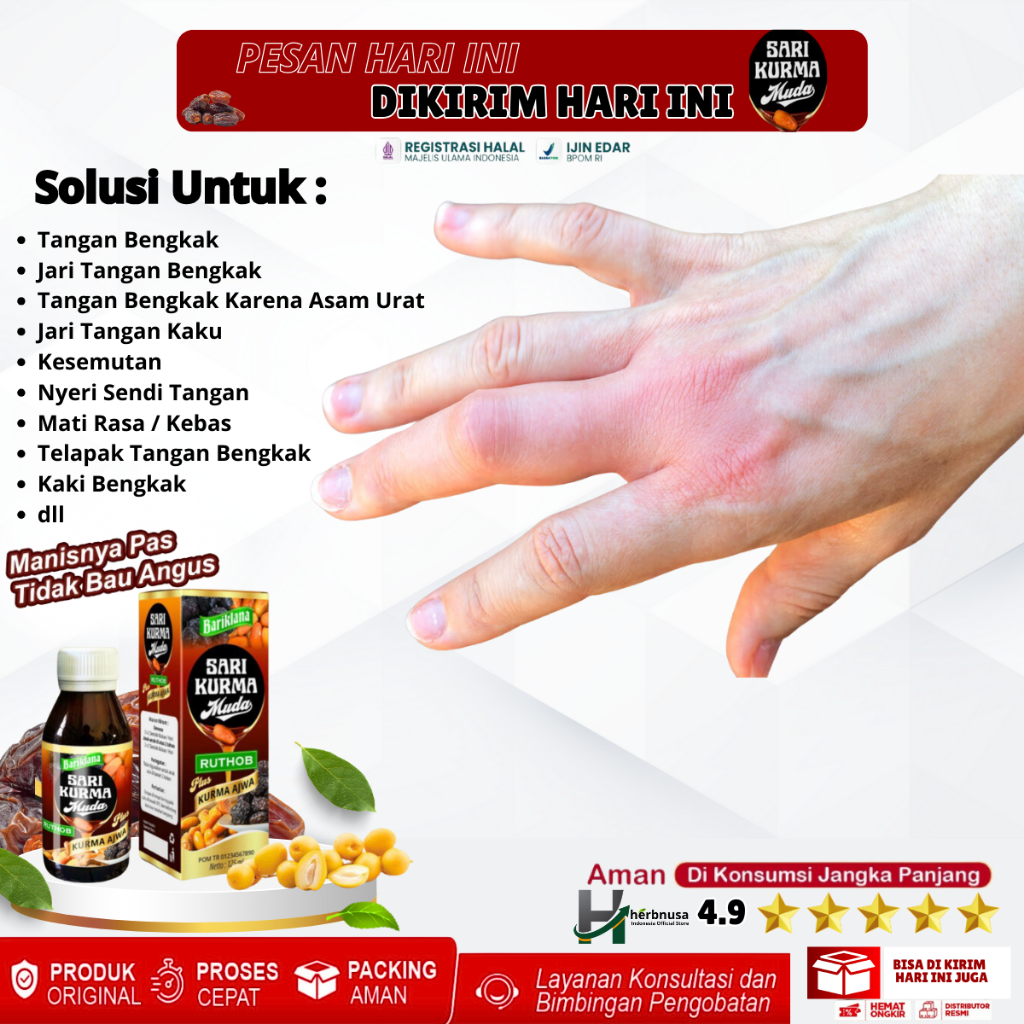 Obat Tangan Bengkak, Obat Jari Tangan Bengkak, Obat Tangan Bengkak Karena Asam Urat, Jari Tangan Kak