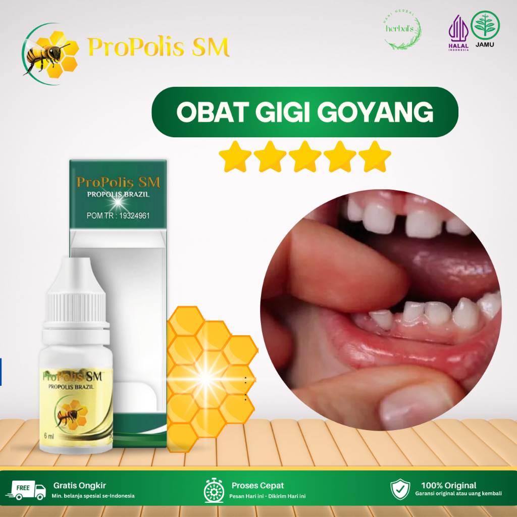 Obat Gigi Goyang, Obat Gigi Goyang Sakit Gigi, Obat Sakit Gusi, Obat Gigi Sensitif, Obat Pereda Nyer