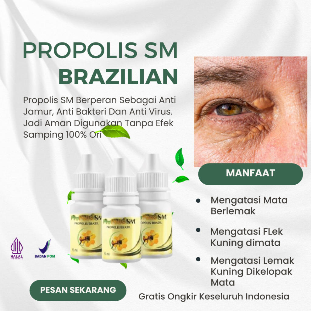 Obat Xanthelasma, Obat Gumpalan Lemak Di Kelopak Mata, Obat Penghilang Xanthelasma, Obat Penghilang 