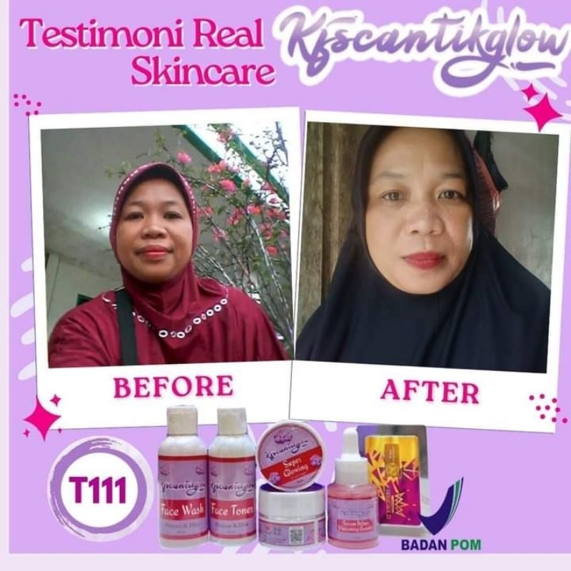 kfs cantik glow skincare