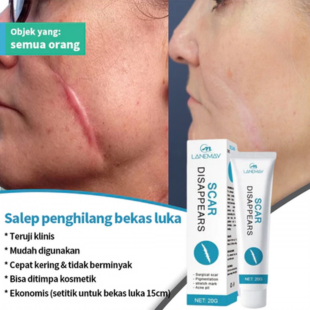 [COD] Salep Bekas Luka Penghilang Bekas Luka Menghilangkan Bekas Gigitan Serangga Bekas Luka Kaki Be