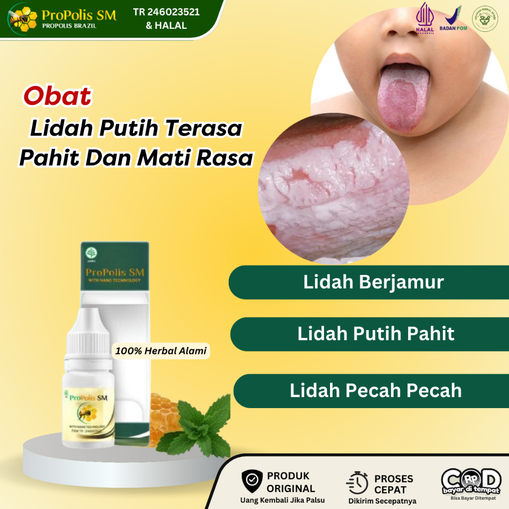 Obat Lidah Berjamur, Obat Lidah Putih, Obat Lidah Pahit, Obat Bau Mulut, Obat Lidah Pecah Pecah, Oba