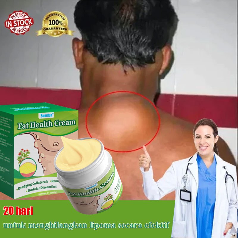 Salep lipoma salep benjolan Lipoma cream Obat benjolan Salep benjolan lipoma Cream lipoma Obat lipom