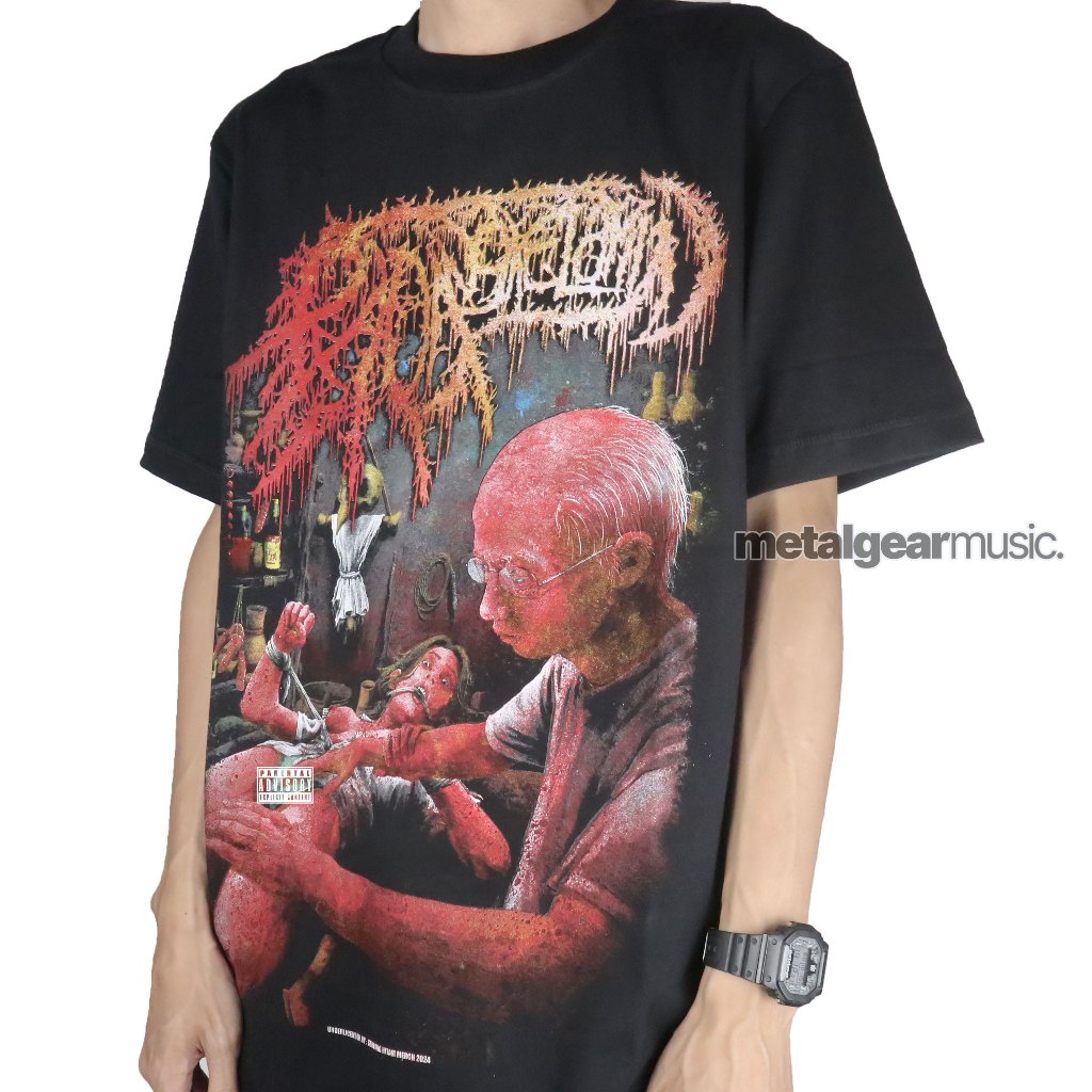 Metalgear Music Original Radang Kelamin - Calon Mertua Tshirt Baju Kaos