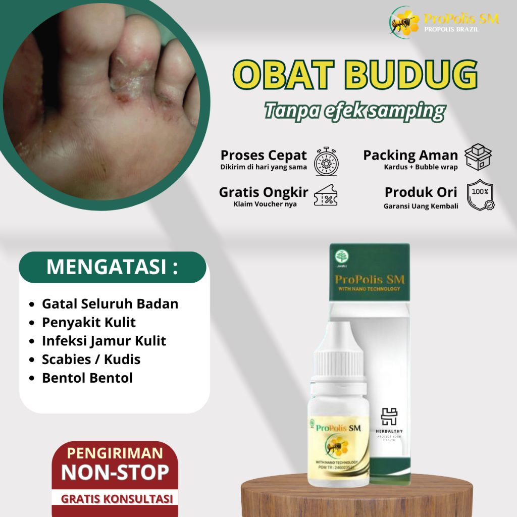 Obat Scabies Kulit Borok Bernanah Budug Untuk Seluruh Badan Obat Kulit Borok Obat Budug Santri Budug