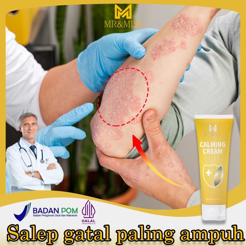 Obat gatal selangkangan salep gatal china paling ampuh obat gatal kulit paling ampuh 20ml salep gata