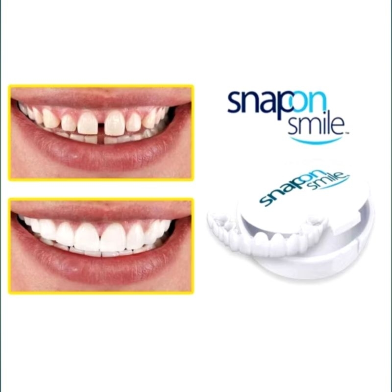 SEPASANG ATAS BAWAH Gigi Palsu Snap on Smile [ Original ] Bahan elastis