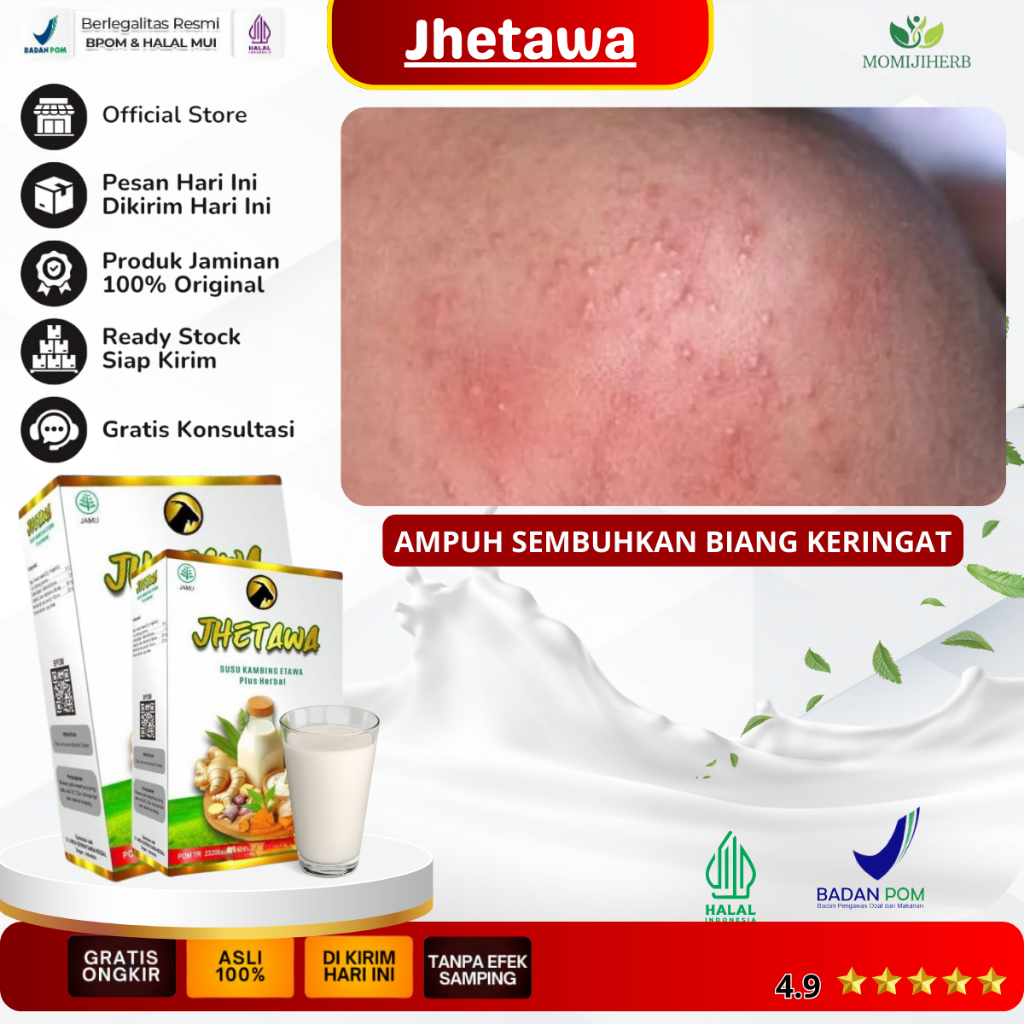 Obat Biang Keringat, Gatal Biang Keringat, Miliaria Rubra, Gatal Seluruh Badan, Alergi Kulit, Bintik