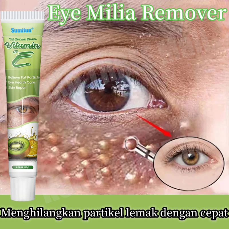krim penghilang milia obat milia di bawah mata salep milia di bawah mata Eye Cream milia remover Kri