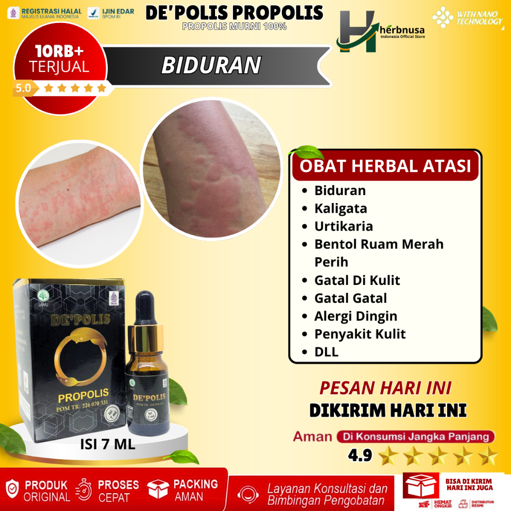 De'Propolis Propolis Brazil Obat Biang Keringat Herbal Penghilang Gatal Biang Keringat Di Kepala Pun