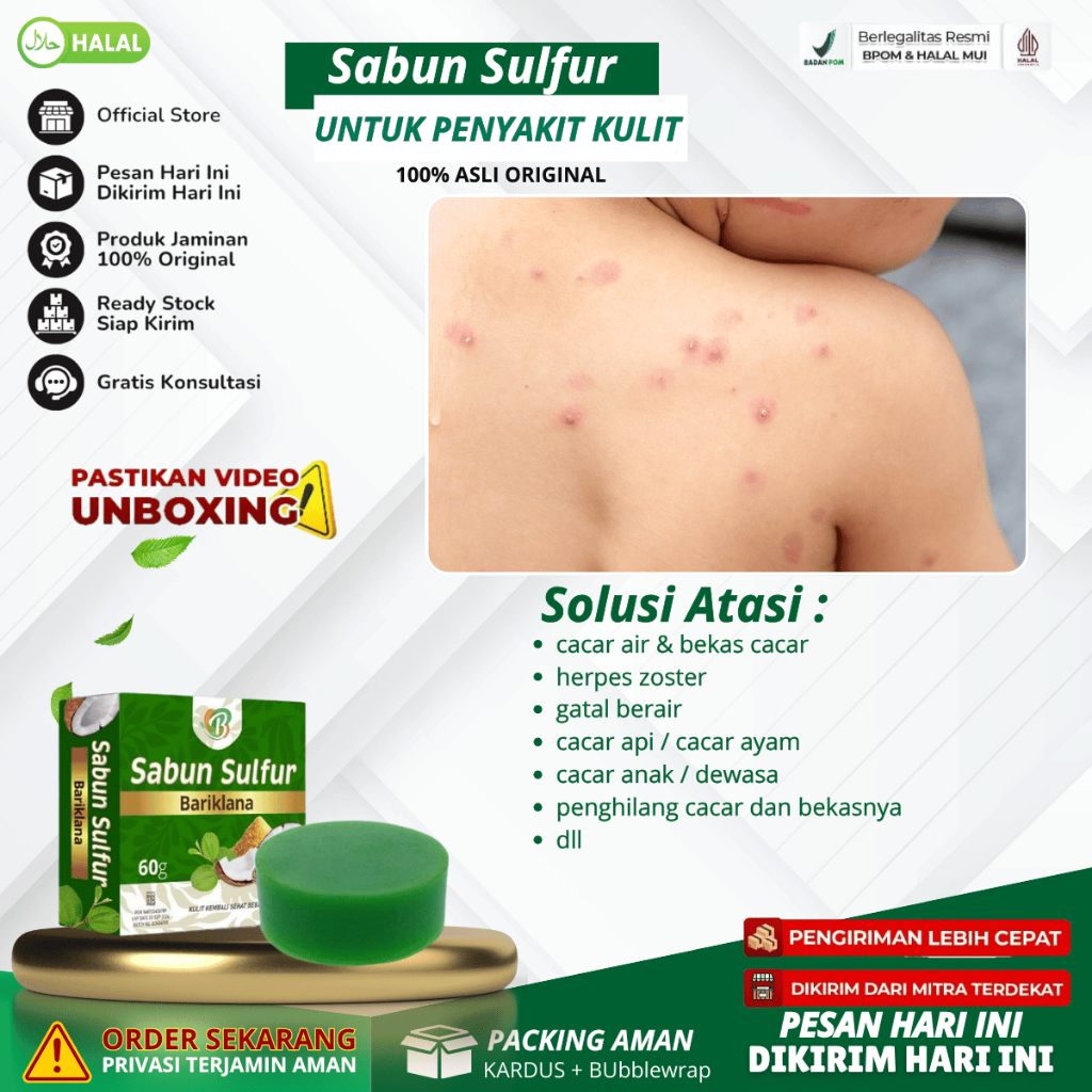 Sabun Sulfur - Sabun Binahong Obat cacar air & bekas cacar, Obat herpes zoster, Obat gatal berair, S