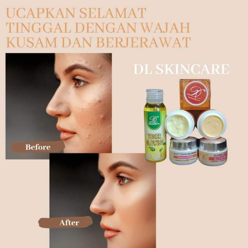 paket DL SKINCARE