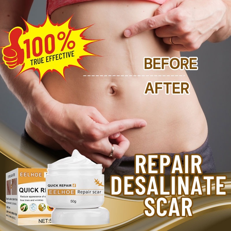 【100% ORI】Salep Krim Penghilang Bekas Luka Krim Jerawat Bekas Salep Perbaikan Bekas Luka/Stretch Mar