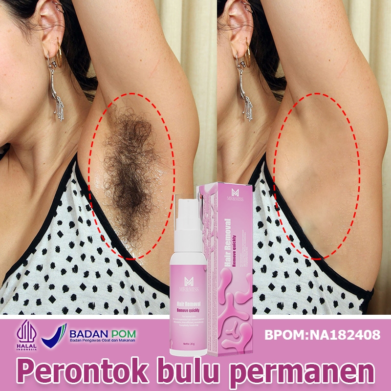 MR&MISS Perontok bulu kemaluan Perontok bulu ketiak Perontok bulu permanen Hair removal cream 20g Kr