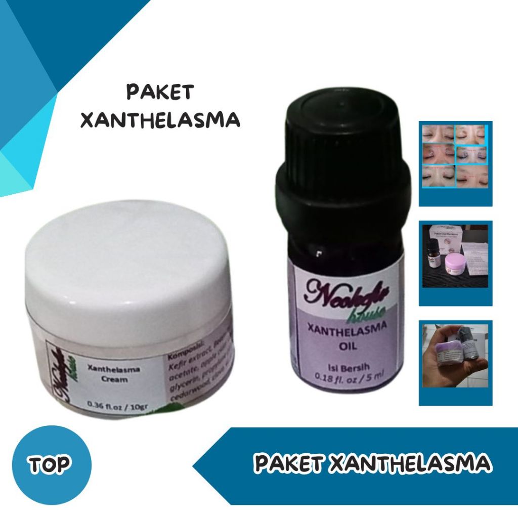 Paket Xanthelasma Solusi Ampuh Atasi Xanthelasma