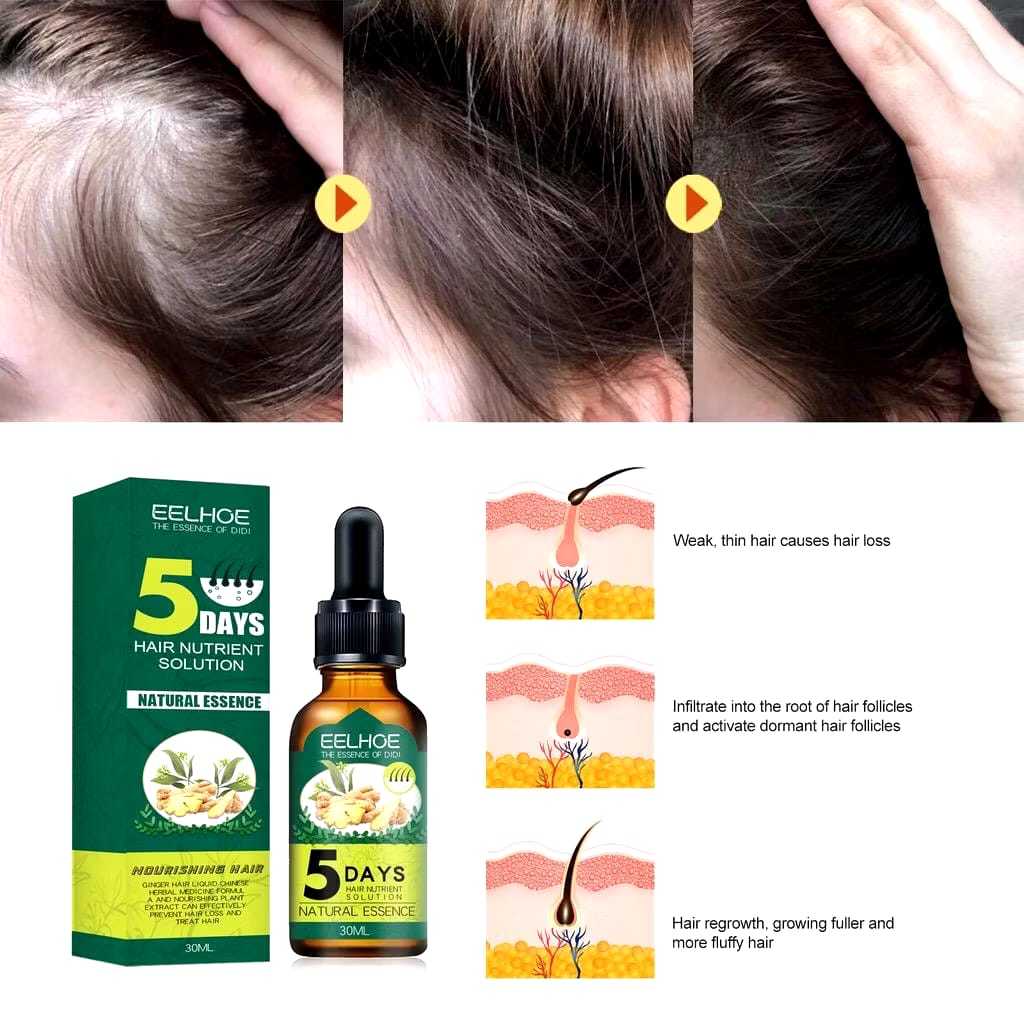 EELHOE Hair Nutrient Solution - Serum Jahe Penumbuh Rambut | Membantu Menutrisi,