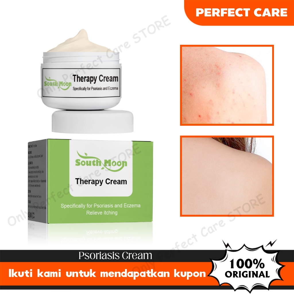 South Moon Psoriasis Antibacterial Cream 20g Skin Itching Relief Inhibit Fungus Urticaria Treatment