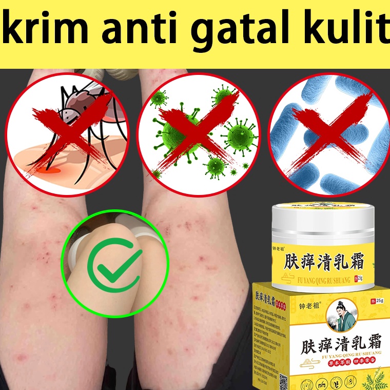 Ready Terunik Salep gatal paling ampuh Obat gatal kulit Obat gatal selangkangan 25g Obat gatal palin