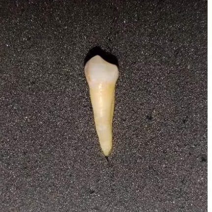 gigi asli praktikum, gigi premolar