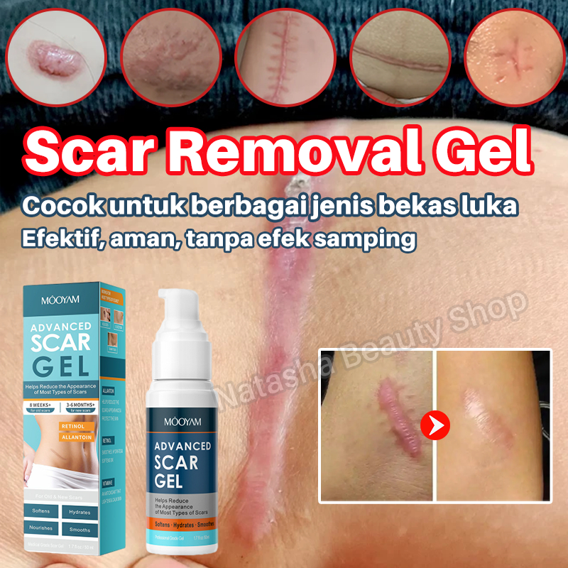 Obat penghilang bekas luka Salep penghilang bekas luka lama menghilangkan stretch mark 60ml bekas gi
