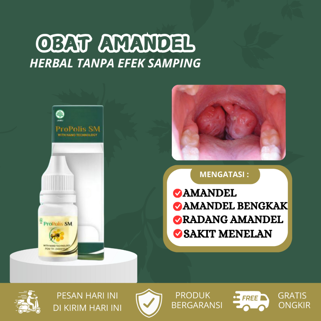 Obat Amandel, Amandel Bengkak Sebelah, Radang Amandel, Sakit Menelan