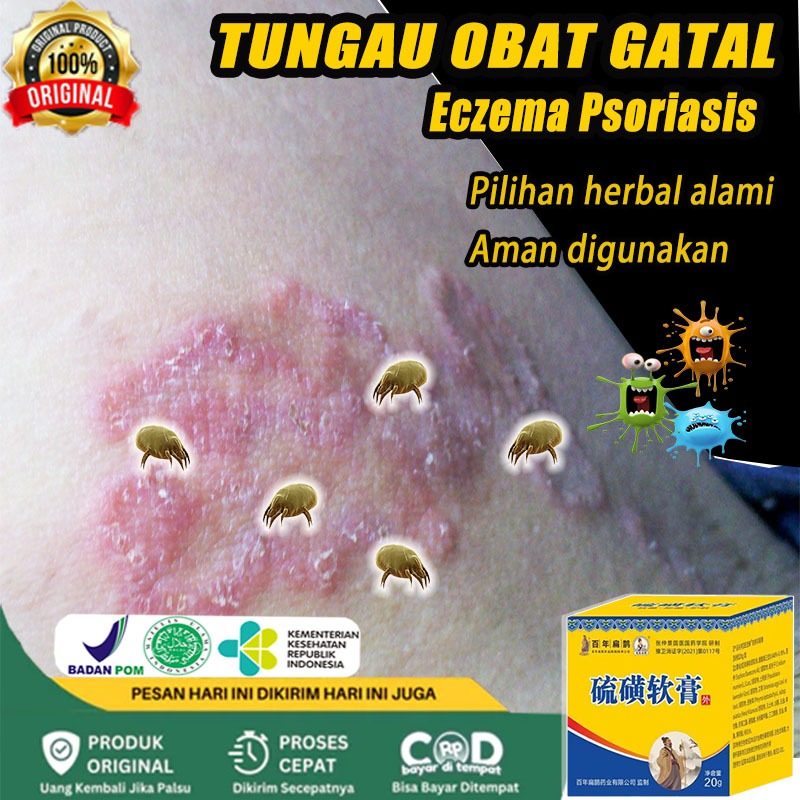 Obat gatal Obat tungau Obat eksim Obat psoriasis 20g Salep gatal salep china gatal paling ampuh