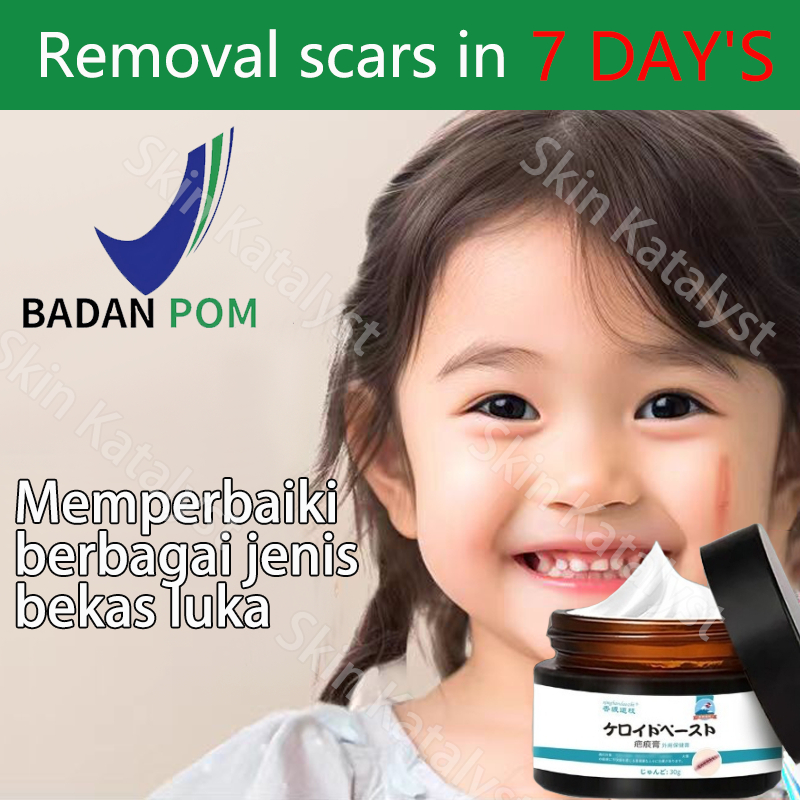 Penghilang bekas luka Penghilang bekas koreng hitam di kaki Penghilang Bekas cacar Bekas lama Bekas 