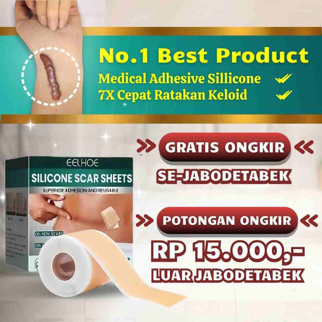 SILLICONE KELO PATCH - plaster keloid patch keloid ampuh manjur solusi basmi keloid membandel alami