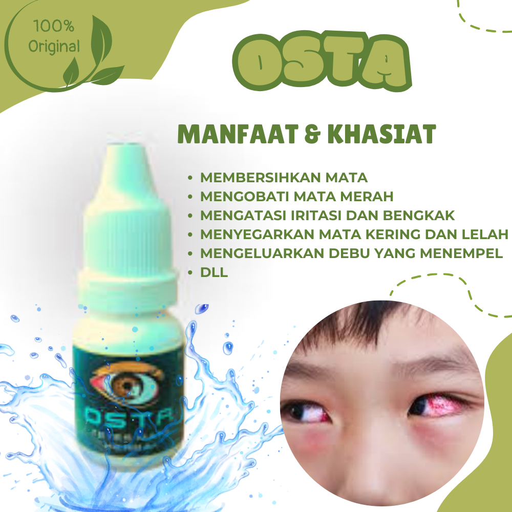 Mata Merah Iritasi, Berlemak, Mata Juling Sebelah, Atasi Dengan OSTA Obat Mata Paling Ampuh