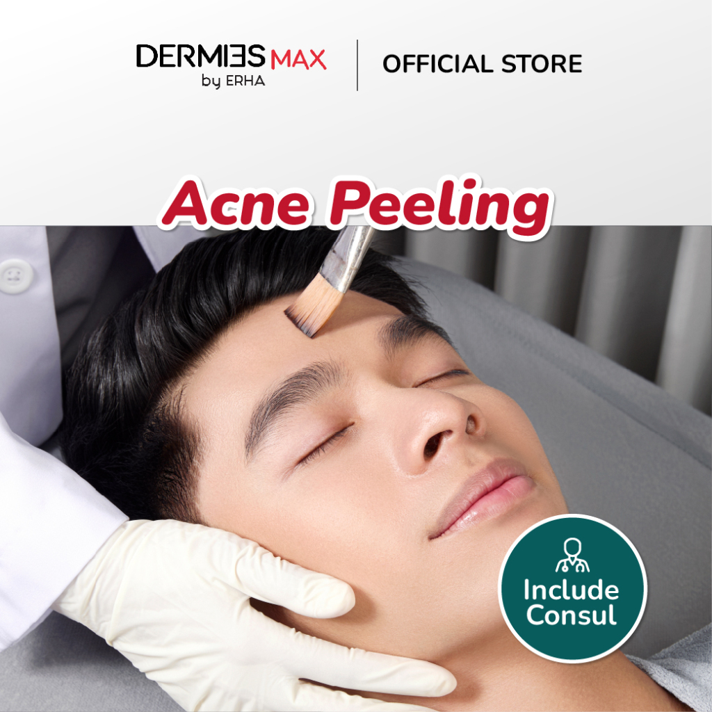 Dermies Max Acne Peeling