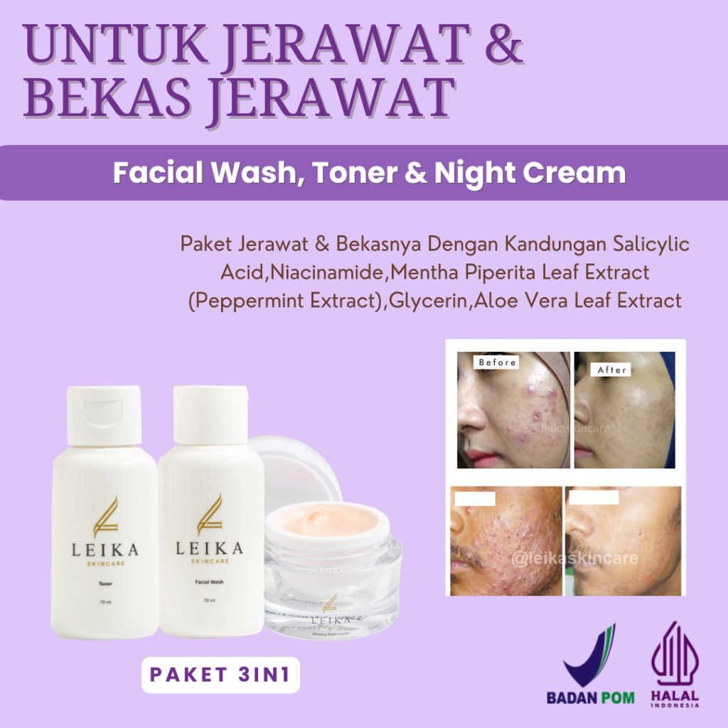 FACIAL WASH + TONER & NIGHT CREAM Penghilang Jerawat Ampuh Penghilang Jerawat Dan Bruntusan Penghila